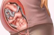 وضعيات غير سليمة يتّخذها الجنين خلال الولادة...هل من داع للقلق؟