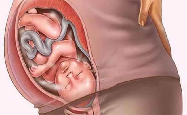 وضعيات غير سليمة يتّخذها الجنين خلال الولادة…هل من داع للقلق؟