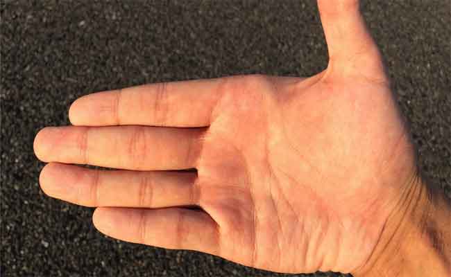 علامات تدلّ على جفاف الجسم…لا تهملوها!