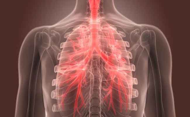 كلّ ما يجب ان تعرفه الحامل عن التهاب الشعب الهوائية لديها…