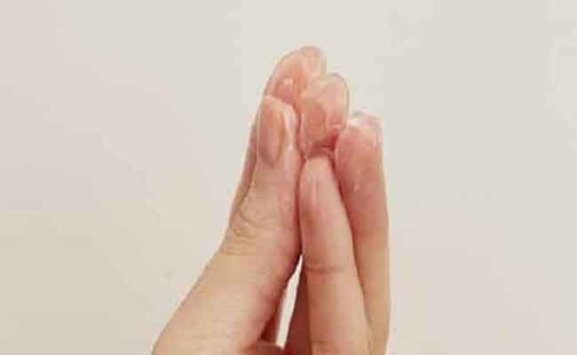 المهبل يفرز مادة بيضاء…هل من داعٍ للقلق؟