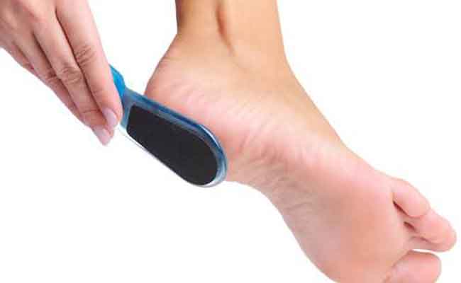 كيف يمكن التخلص من تشققات القدمين منزلياً؟