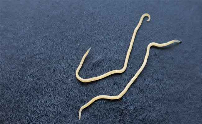 كيف يمكن التعرف على اعراض الديدان عند الأطفال؟