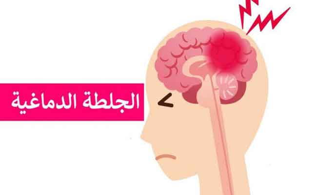 7 أشياء يمكنكم القيام بها للوقاية من السكتة الدماغية…
