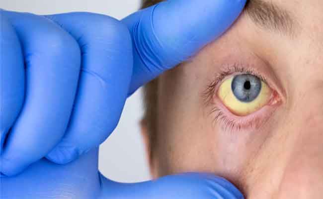 هل يمكن الشفاء من التهاب الكبد؟