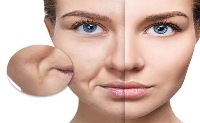 هل تريدين تجنّب خطوط الابتسامة؟ نكشف لكِ العوامل المسبّبة لها