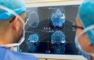 تطوير تقنية ثورية لقتل خلايا سرطان الدماغ دون جراحة‎‎...