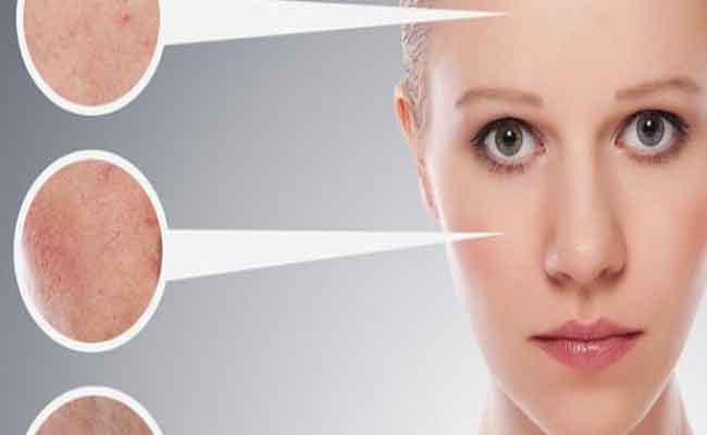 كيف تعتنين ببشرتكِ اذا كانت دهنية وباهتة؟