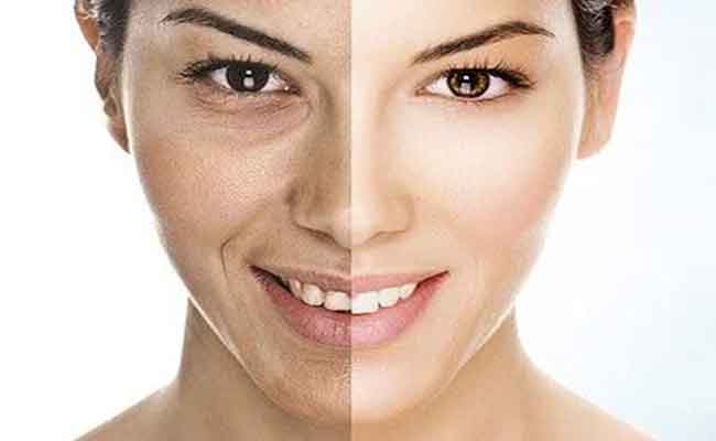 كلّ ما تريدين معرفته عن الفيلر قبل البدء باستخدامه