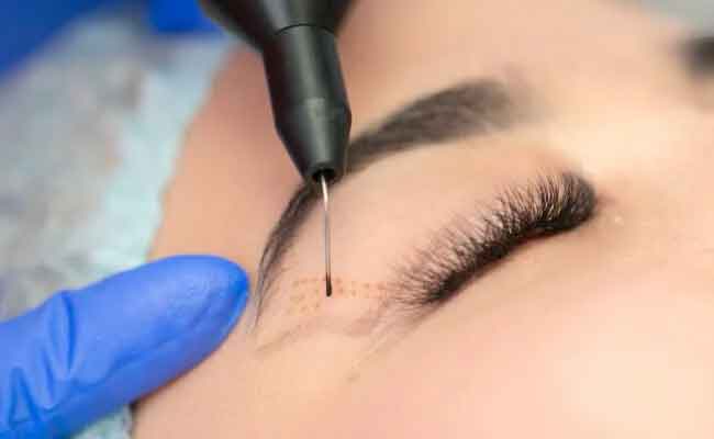 هل تفكّرين باجراء جراحة تحديد الجفون؟ اليكِ ما يجب أن تعرفيه عنها