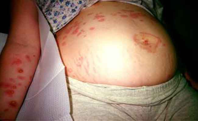 بماذا تشعر الحامل؟ أعراض وتغيّرات شائعة طيلة فترة الحمل