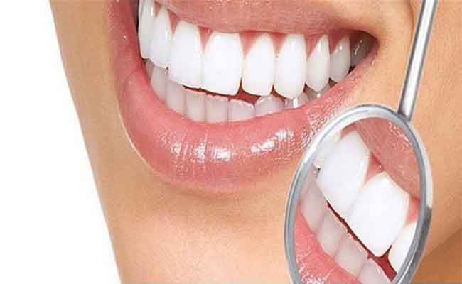 ابتسامة هوليوود…هل لها اضرار؟ اليكم الحقيقة