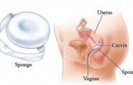 كلّ المعلومات التي يجب أن تعرفيها عن اسفنجة منع الحمل...