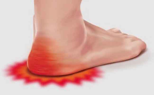 كيف يمكنكم علاج مسمار القدم بسهولة في المنزل؟
