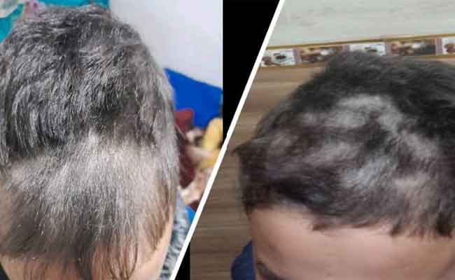 عقاب جسدي بأبعاد نفسية: معلمة تعاقب 4 تلاميذ بقص شهرهم أمام زملاءهم بسطيف