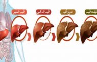 ما هي الأعراض التي تُشير الى تراكم السموم في الكبد؟