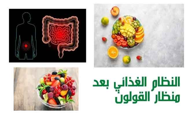 الأكل المناسب بعد منظار القولون…لتجنّب المضاعفات