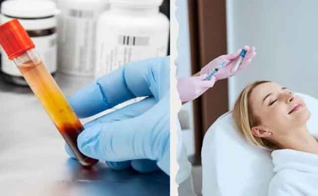 تقنية البلازما PRP علاج فعال في حالات تأخر الإنجاب…