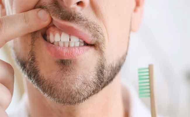 علاج اللثة الملتهبة بالأعشاب الطبيعية…فعّال بشكل مذهل