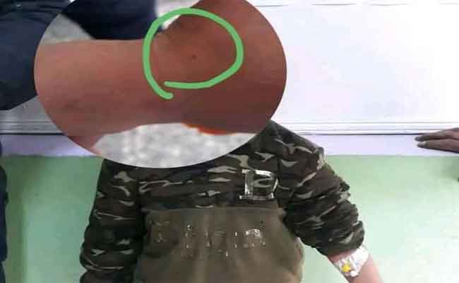 وخز تلميذين بإبرة من مجهول يخلق حالة من الهلع وسط الأولياء بجيجل