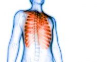 ما الذي يمكن أن يسبّب لكم الألم في القفص الصدريّ؟