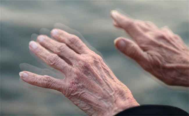 اختبار جديد لاكتشاف مرض باركنسون قبل الإصابة…وفق دراسة