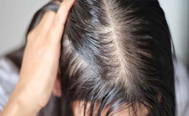 كيف يمكنك تكثيف الشعر الخفيف بطرق طبيعية؟