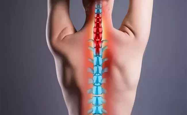 أعراض ديسك الرقبة مؤلمة…وتتطلب العناية الطبية