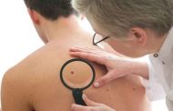 سرطان الجلد: الأعراض الأولى التي تستوجب استشارة طبيب الجلد