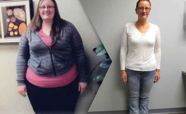 جراحة ربط المعدة لعلاج السمنة تساعد في الوقاية من الخرف…