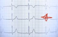 النوبة القلبية: النساء أكثر عرضة للوفاة مرتين بعد الإصابة