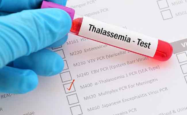 علامات الإصابة بالثلاسيميا وأسبابها وطريقة التعايش من المرض…