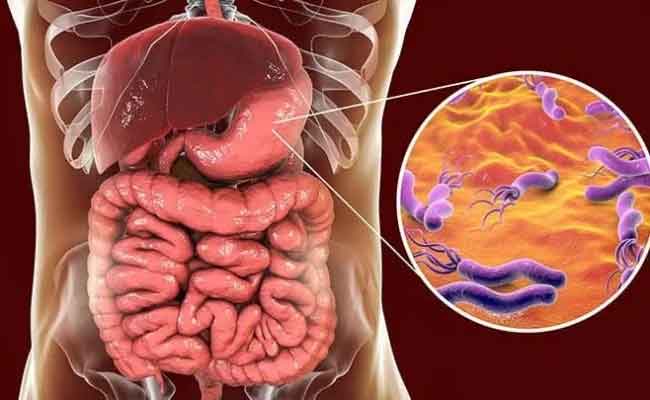 أفضل علاج لجرثومة المعدة…يساعدك على التعافي سريعاً