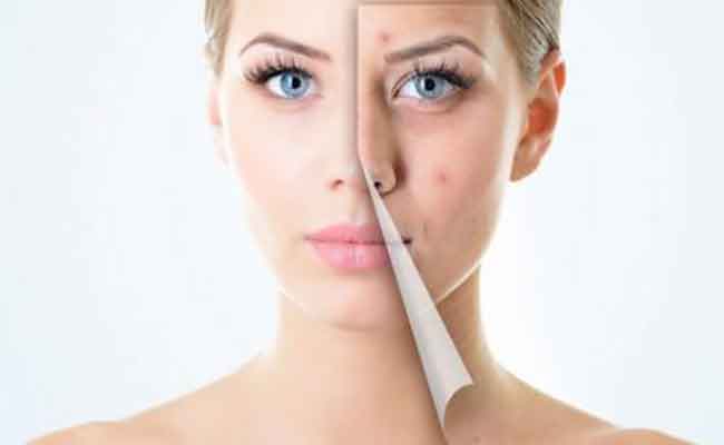 هل تعلمين أهمية الكولاجين لبشرتك؟