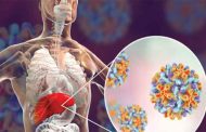 أمراض الكبد: عوامل بيئية جديدة تؤثر في المرض وفق باحثين