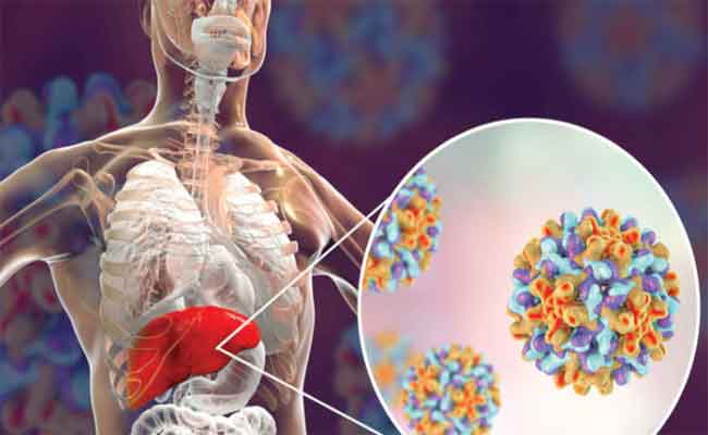 أمراض الكبد: عوامل بيئية جديدة تؤثر في المرض وفق باحثين
