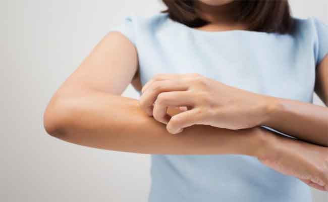 علاجات فعالة لتقليل الطفح الحراري بشكل طبيعي وبمكونات من مطبخك…