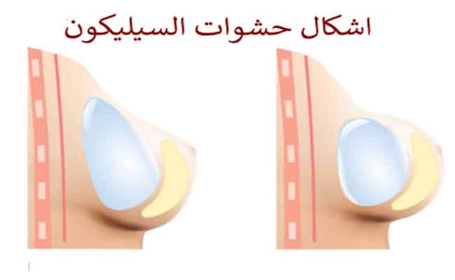 تثبيت الثدي بين تكبير حجمه وتصغيره Mastopexy…