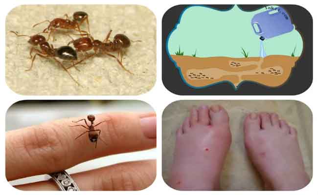 فوائد قرصة النمل عديدة…اكتشفيها واكتشفي طرق تخفيف الألم