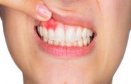 أسباب وأعراض خراج الأسنان أثناء الحمل وكيفية الوقاية