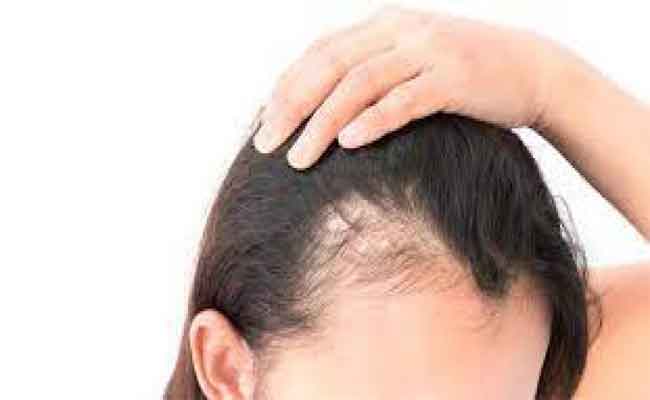 علاج تساقط الشعر بالخلايا المجهرية…طبيب جلدية يتحدث