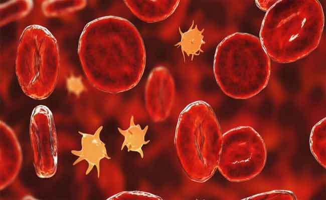 الأطعمة التي تسبّب نقص الصفائح الدموية وفق اختصاصية تغذية…