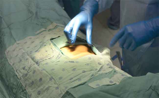 استئصال المرارة: نصائح غذائية هامّة للمرضى بعد هذه المرحلة…