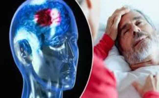 السكتة الدماغية: ارتفاع درجات الحرارة قد يزيد من خطر الإصابة