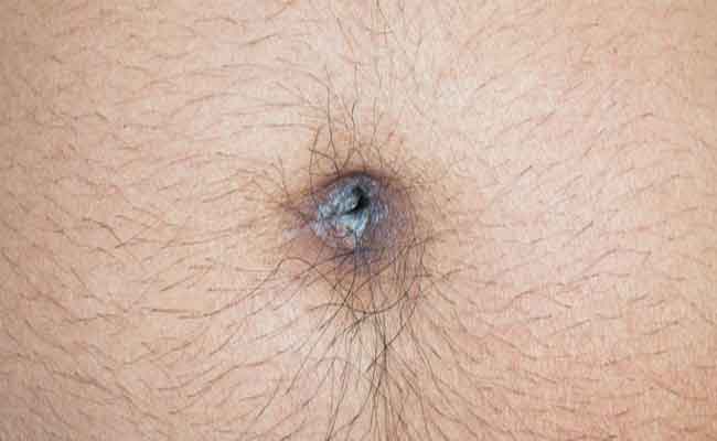 طريقة تنظيف السرة للكبار بسيطة…لتجنّب العدوى والرائحة