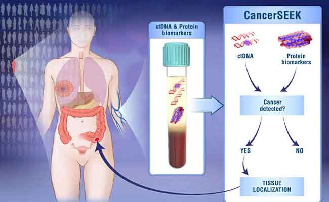اختبار منزلي…تحليل جديد يتنبأ بإصابتكِ بالسرطان مبكراً
