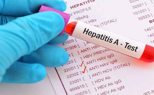 انتشار مرض الفيروس الكبدي “أ” في عين بسام ومسؤول يطمئن