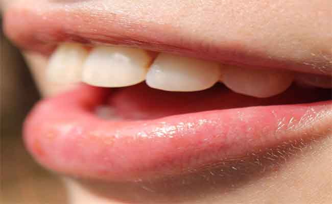 تجربتي مع القرنفل في تسكين ألم الأسنان…لا تفوتي قراءتها