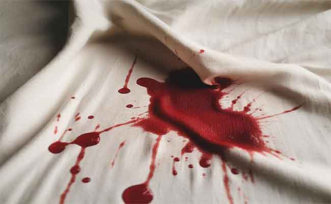 أسباب النزيف أثناء الحمل…