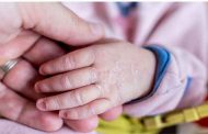 5 أمراض تسبب جفاف الجلد عند الرضع وإليكِ أبرز العلاجات...